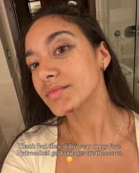 The not so glamorous side of stunts, let me deinfluence you for a second. I  know I share a lot of the fun and exciting moments of my life in film and