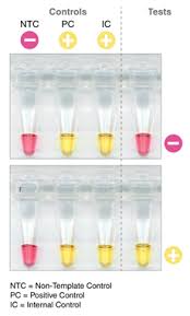 Lamp cord exits from side of socket eliminating the need to drill a hole for power cord. Sars Cov 2 Rapid Colorimetric Lamp Assay Kit Neb