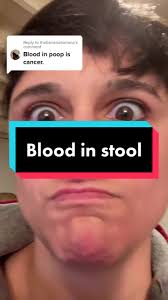 Image result for blood in stool human poop