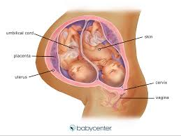 9 out of every 10 multiple births are of twins. Fraternal Twins In The Womb 32 Weeks Babycenter