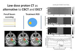 Proton coin price & market data. Proton Ion Ct Experimental Medical Physics Lmu Munich