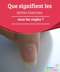 Vous avez remarqué une tache blanche sur les ongles de votre enfant ? Que Signifient Les Taches Blanches Sous Les Ongles Ameliore Ta Sante Tache Blanche Ongle Tache Ameliore Ta Sante
