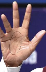 Maybe you would like to learn more about one of these? Why Do I Have An Eye Sign At The Top Of The Thumb Quora