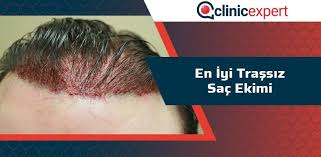 En Iyi Tirassiz Sac Ekimi Clinicexpert Uluslararasi Saglik Hizmetleri