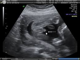 Pin On Baby Gender