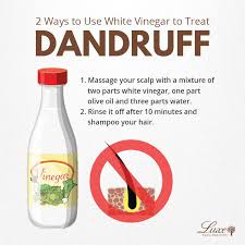 You Think Vinegar Is Only For Cooking It Can Remove Your Dandruff Too Actually White Vinegar Is One Of The Best Home Hair Dandruff Dandruff Dandruff Remedy