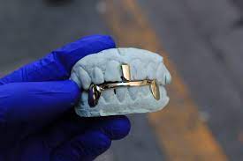 This set includes everything you need to get started taking mold impressions of your customers! Teach You How To Make Gold Teeth And Start A Grillz Business By Badlikewolf Fiverr