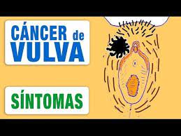 Pin En Remedios