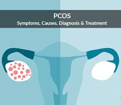 Pcos isn't a new condition. Pcos Polycystic Ovary Syndrome Symptoms Causes Diagnosis Treatment