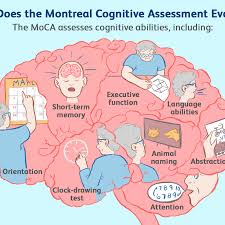 B, top, scatter plot of the of the relationship between moca and libon scores; Montreal Cognitive Assessment Moca Test For Dementia