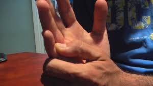 Große auswahl an finger fix. Jammed And Broken Pinky Finger Youtube