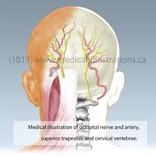 Occipital Neuralgia Cervical Nerves Diagram Pinched Nerves In Right C1 C2 Nerves In Neuralgia Migraine Headaches Occipital Neuralgia