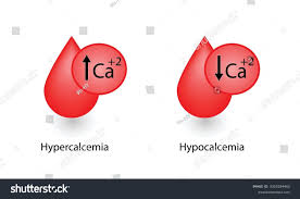 Image result for Hypercalcemia