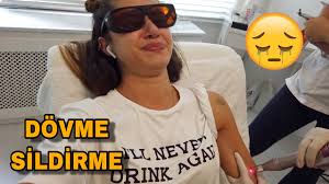 Pinterest murat boz dövme kalıp. Dovme Silme Doktorum By Orhan Kumek