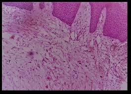 Loose connective tissue has some fibroblasts, although macrophages are present as well. Photomicrograph 1 H E Stain Shows Loose Connective Tissue With A Download Scientific Diagram