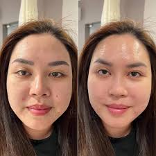 Top 5 Thẩm mỹ viện uy tín và chất lượng nhất quận Tân Phú, TP. Hồ