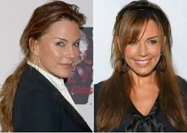 Krista Allen Plastic Surgery Before And After Celebrity Surgeries Celebrity Surgery Krista Allen Plastic Surgery