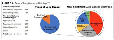 Sometimes lung cancer does not cause any signs or symptoms. Diagnosis Staging And Testing For Nonsquamous Nsclc