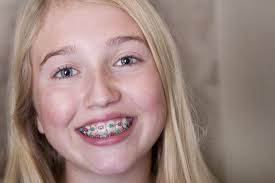 Crest.com has been visited by 10k+ users in the past month Orthodontist In Far North Dallas Do Braces Hurt Getting Braces