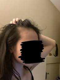 Im 16 Years Old And Ive Had A Receding Hairline For As Long As I Can Remember And When I Shower In 2020 Hair Falling Out Hairstyles For Receding Hairline Hair Vitamins