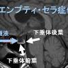 空洞空洞 (kūdō kūdō) 6 translations. 1