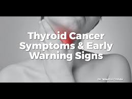 Though thyroid cancer is a rare cause of neck pain, pain is usually a good indicator that something in your body needs attention. Thyroid Cancer Symptoms Early Warning Signs Youtube