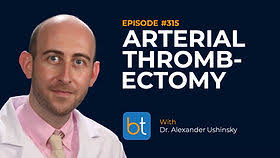 Building an Acute Limb Ischemia Program: Focus