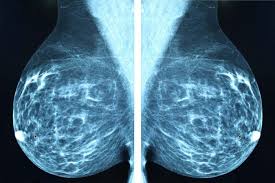 Maybe you would like to learn more about one of these? 8 Reasons To Request An Earlier Mammogram Best Health Magazine