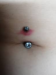 I Got My Belly Button Pierced Week Ago And Now It Looks Like This Is This Normal And I Shouldn T Be Worried It Doesn T Hurt Anymore But Sometimes It S Itchy Piercing