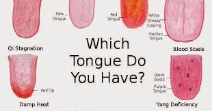 interesting facts what your tongue can tell you about your