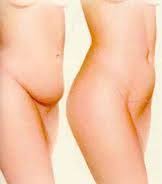 Holistic C Section Recovery System Burrell Education C Section Recovery C Section Belly C Section Workout