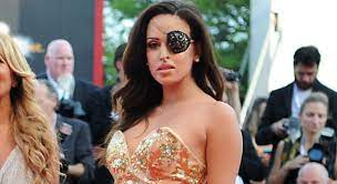 Gessica notaro, who has worked as a tv presenter as well as a dolphin trainer, was was doused in acid by her former partner, jorge edson tavares, who stalked and threatened her after she broke up. Chi E Gessica Notaro Storia E Fidanzato Della Miss Sfregiata Con L Acido