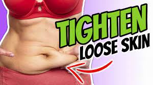 How To Tighten Loose Belly Skin After Weight Loss | Liveleantv - Youtube