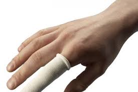 Putus apa tak boleh disambung semula for more information and source, see on this link : Apakah Jari Putus Bisa Disambung Lagi Ini 11 Pertolongan Pertamanya