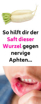 Aphten sind häufig sehr schmerzhafte geschwüre, die sich auf dem zahnfleisch, der zunge oder der mundschleimhaut manifestieren. So Wirst Du Aphthen Schnell Wieder Los Aphthen Im Mund Aphten Im Mund Hausmittel Aphten Im Mund Kinder Aphten Auf Der Z Fruit Food Punny Halloween Costumes