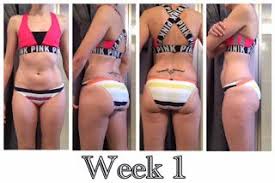 Pin On Brazil Butt Lift