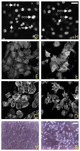 We did not find results for: Observation By Phase Contrast Microscopy Of Cell Morphology After 4 Download Scientific Diagram