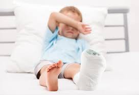 Image result for Fractures in Children