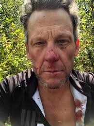 Well, sometimes you're the hammer and sometimes you're the nail. The Tom  Blake trail tried to KO my ass today. Took quite the blow to the noggin so  I swung by the