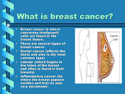 An estimated 46,000 women and 300 men died of breast cancer in 1994, in spite of treatment including surgical removal of the cancerous breast. Breast Cancer Ppt Download