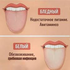 как избавиться от неприятного запаха изо рта из за желудка Pin By Lena Familiya On Zdorove Visor
