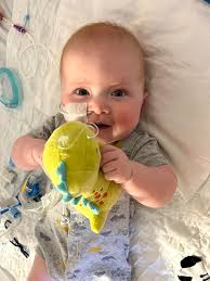 Grayson's helmet improved his head shape significantly