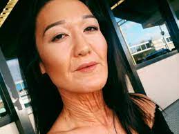 Rare Disease Makes This 26 Year Old Woman Look Decades Older You
