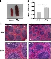 Three ligaments originating from the surrounding structures attach to the spleen. Spleen Derived Lipocalin 2 In The Portal Vein Regulates Kupffer Cells Activation And Attenuates The Development Of Liver Fibrosis In Mice Laboratory Investigation