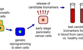 Pancreatic cancer — overview covers symptoms, risk factors, prevention, diagnosis, surgery, chemotherapy and other treatment for cancer of during an endoscopic ultrasound of the pancreas, your doctor inserts a thin, flexible tube (endoscope) down your throat and into your abdomen. Hosting Account Suspended Pancreatic Cancer Biomarkers