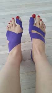 Kinesiology Taping For Bunion Functional Left And Fascial Right Techniques Fersenschmerzen Fitness Workouts Kinesiologie Tapen