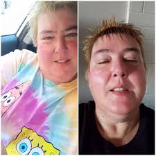 5 weeks into cycle.. how am I looking?