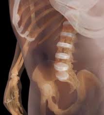 Maybe you would like to learn more about one of these? Human Spine Spinal Cord Facts Dk Find Out