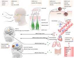 Frontiers Applications Of Non Invasive Neuromodulation For The Management Of Disorders Related To Covid 19 Neurology
