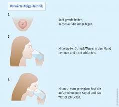 Wenn S Nicht Rutscht